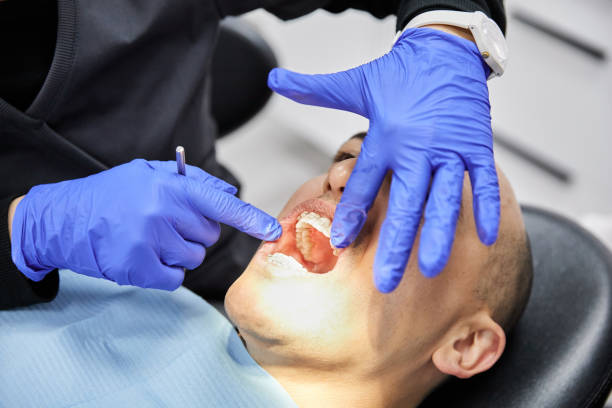 Best Emergency Wisdom Teeth Removal in Succasunna, NJ